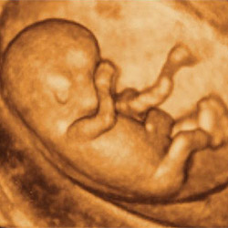 Trójwymiarowy obraz USG poczętego dziecka (źródło: http://www.medicus.ie/foto/usg4d.jpg)